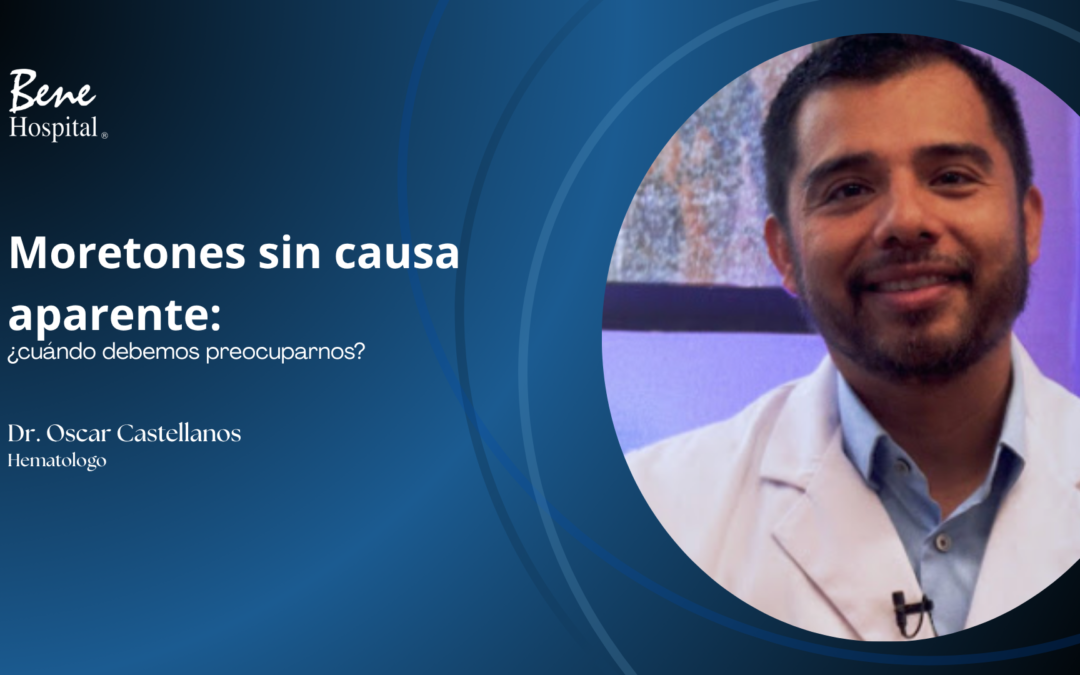 Moretones sin causa aparente: ¿cuándo debemos preocuparnos?
